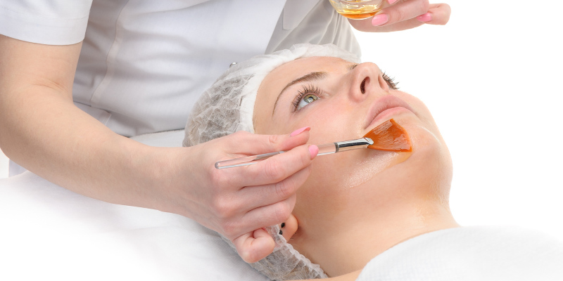 Chemical Peels in Knoxville, Tennessee