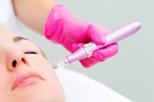 What is Microneedling?