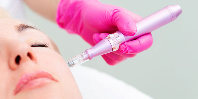 What is Microneedling?