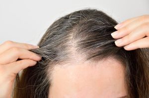 What You Need to Know About Hair Restoration What You Need to Know About Hair Restoration