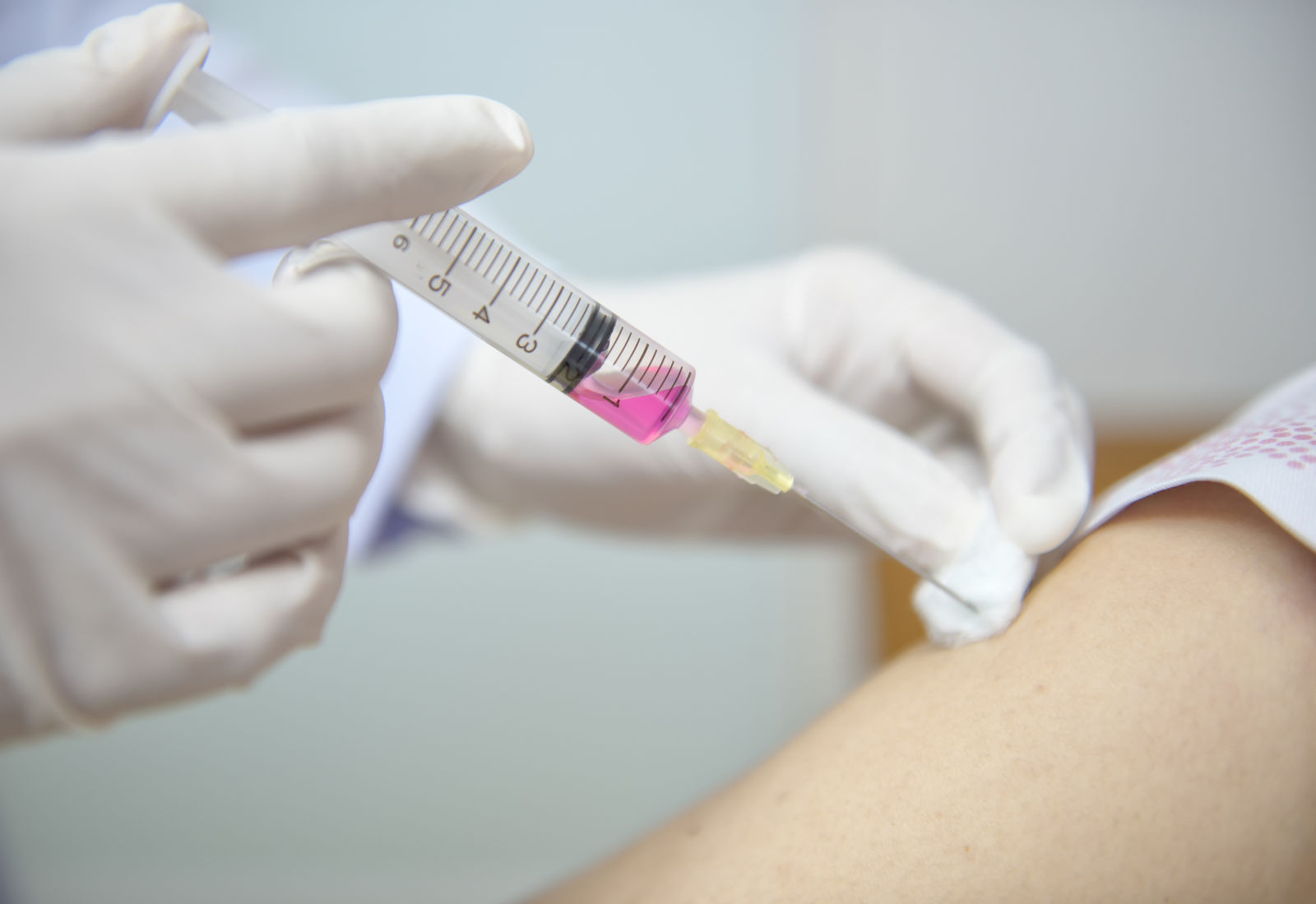 Restylane Defyne in Knoxville, Tennessee