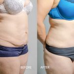 ShapeScale Body Image