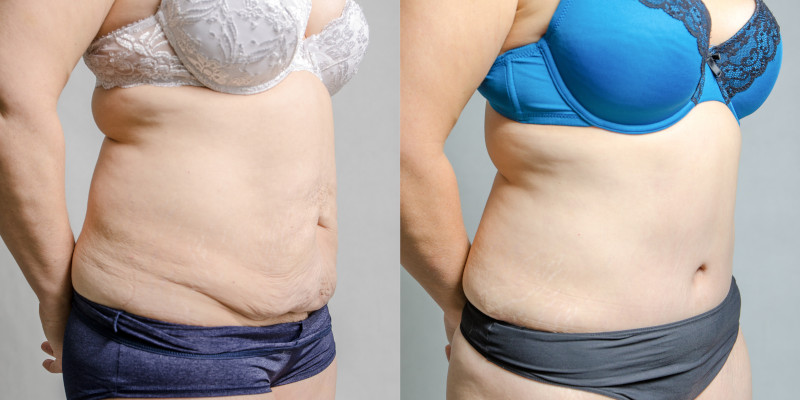 ShapeScale Body Image in Knoxville, Tennessee
