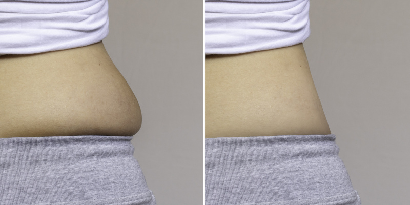 Physiq Body Contour in Knoxville, Tennessee
