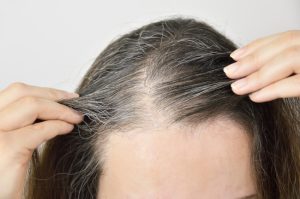 How Does Hair Restoration Work?