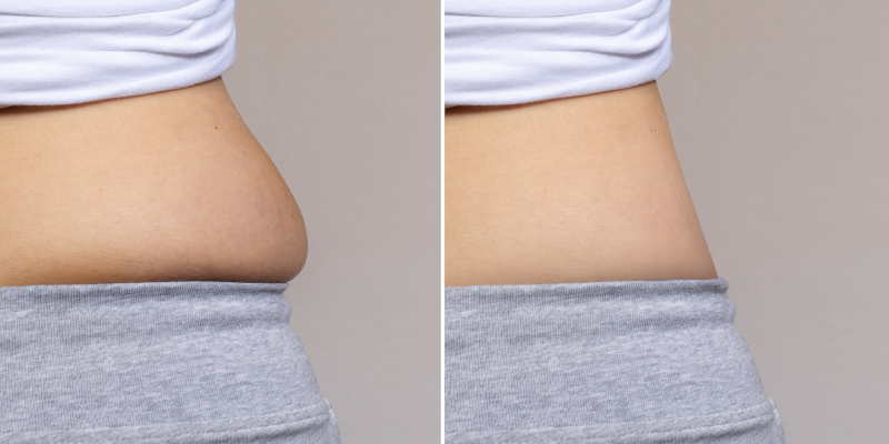 Body Treatments, Knoxville, TN