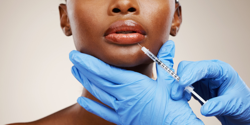 Lip Filler, Knoxville, TN