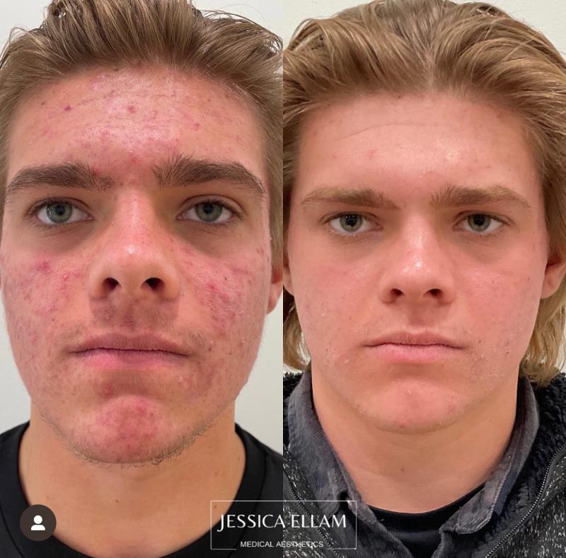 Sylfirm and Medical Grade Skincare