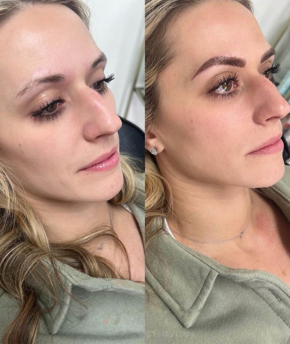 weight loss consultation